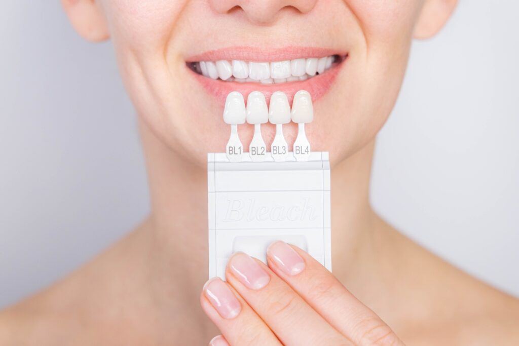 dental veneers Fort Collins